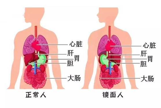 什么是镜像人 可以活多久